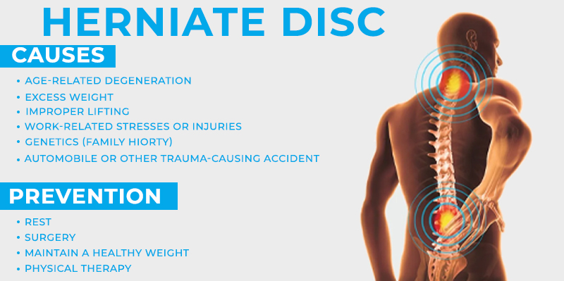 Causes and Symptoms of Herniated Disc ...