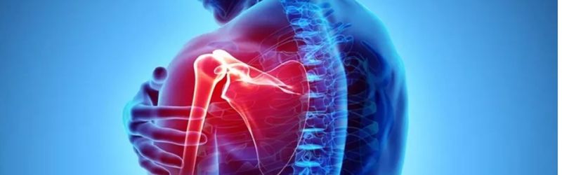 Preventions for Rotator Cuff Injuries