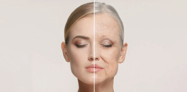 How To Reduce Wrinkles? Top 10 Natural Ways